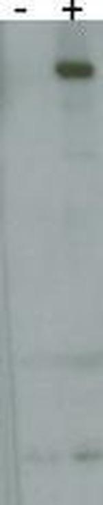 LRRK2 Antibody in Western Blot (WB)