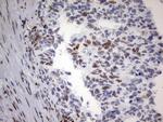 PARN Antibody in Immunohistochemistry (Paraffin) (IHC (P))
