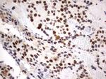 PARN Antibody in Immunohistochemistry (Paraffin) (IHC (P))