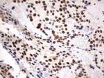 PARN Antibody in Immunohistochemistry (Paraffin) (IHC (P))