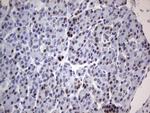 PARP1 Antibody in Immunohistochemistry (Paraffin) (IHC (P))