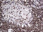 PARP1 Antibody in Immunohistochemistry (Paraffin) (IHC (P))