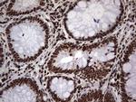 PARP1 Antibody in Immunohistochemistry (Paraffin) (IHC (P))