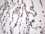 PARP1 Antibody in Immunohistochemistry (Paraffin) (IHC (P))