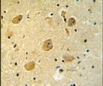 PARP16 Antibody in Immunohistochemistry (IHC)