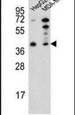 PARP16 Antibody in Western Blot (WB)