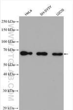 PARP2 Antibody in Western Blot (WB)