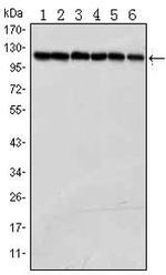 PARP1 Monoclonal Antibody (7A10)