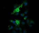 PARVA Antibody in Immunocytochemistry (ICC/IF)