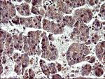 PARVA Antibody in Immunohistochemistry (Paraffin) (IHC (P))