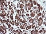 PARVA Antibody in Immunohistochemistry (Paraffin) (IHC (P))