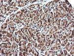 PARVA Antibody in Immunohistochemistry (Paraffin) (IHC (P))