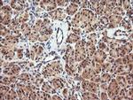PARVA Antibody in Immunohistochemistry (Paraffin) (IHC (P))