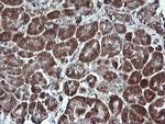 PARVA Antibody in Immunohistochemistry (Paraffin) (IHC (P))