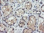 PARVA Antibody in Immunohistochemistry (Paraffin) (IHC (P))