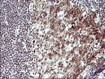 PARVA Antibody in Immunohistochemistry (Paraffin) (IHC (P))