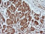 PARVA Antibody in Immunohistochemistry (Paraffin) (IHC (P))