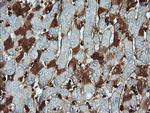 PARVA Antibody in Immunohistochemistry (Paraffin) (IHC (P))