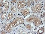 PARVA Antibody in Immunohistochemistry (Paraffin) (IHC (P))