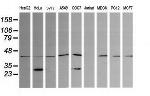 PARVA Antibody in Western Blot (WB)