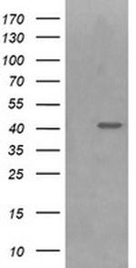 PARVA Antibody in Western Blot (WB)