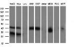 PARVA Antibody in Western Blot (WB)