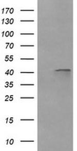 PARVA Antibody in Western Blot (WB)