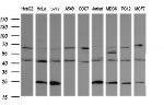 PARVA Antibody in Western Blot (WB)