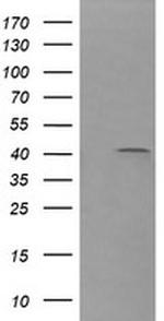 PARVA Antibody in Western Blot (WB)