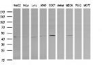 PARVA Antibody in Western Blot (WB)