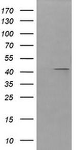 PARVA Antibody in Western Blot (WB)