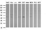 PARVA Antibody in Western Blot (WB)