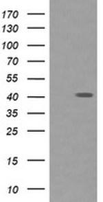 PARVA Antibody in Western Blot (WB)