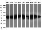 PARVA Antibody in Western Blot (WB)