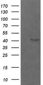 PARVA Antibody in Western Blot (WB)