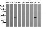 PARVA Antibody in Western Blot (WB)