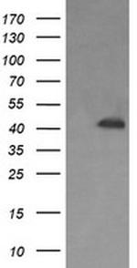 PARVA Antibody in Western Blot (WB)