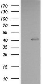 PARVA Antibody in Western Blot (WB)