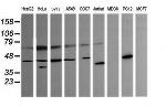 PARVA Antibody in Western Blot (WB)