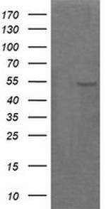 PARVA Antibody in Western Blot (WB)