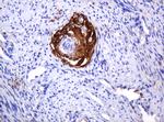 PARVB Antibody in Immunohistochemistry (Paraffin) (IHC (P))