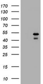 PARVB Antibody in Western Blot (WB)