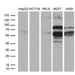 PATZ1 Antibody in Western Blot (WB)