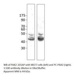 Pax2 Polyclonal Antibody