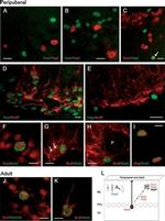 PAX2 Antibody in Immunocytochemistry (ICC/IF)