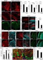 PAX2 Antibody in Immunohistochemistry (IHC)