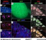 PAX2 Antibody in Immunohistochemistry (IHC)