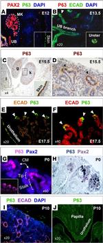 PAX2 Antibody in Immunohistochemistry, Immunocytochemistry (IHC, ICC/IF)