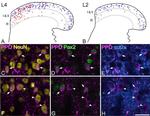 PAX2 Antibody in Immunohistochemistry (IHC)