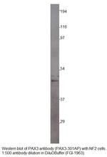 PAX3 Polyclonal Antibody